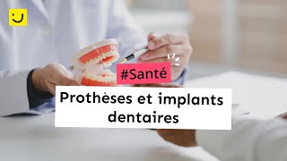 Prothèses et implants dentaires [upl. by Fancie31]