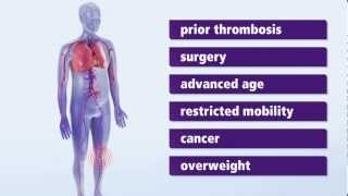 About Thrombosis Symptoms and risk factors for deep vein thrombosis DVT [upl. by Akir]