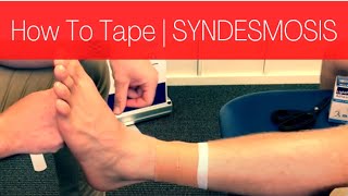 HOW TO TAPE A SYNDESMOSIS HIGH ANKLE SPRAIN [upl. by Heshum]