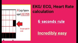 Heart Rate on ECG EKG rhythmURDU HINDI [upl. by Trisa]