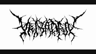 【Veiyadra】 Putrid Infection→Sanguineous Mortuary Brutal Death Metal [upl. by Fatma]