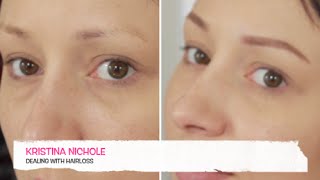 Makeup For Chemo Patients Filling In Your Eyebrows [upl. by Devora]