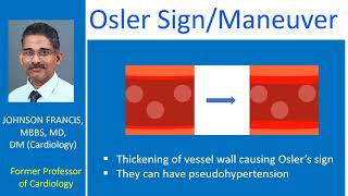 Osler SignManeuver [upl. by Frayne629]