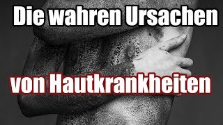 Was dir dein Arzt nicht sagt  Die wahren Ursachen von Hautkrankheiten Teil 12 [upl. by Kcirednek]