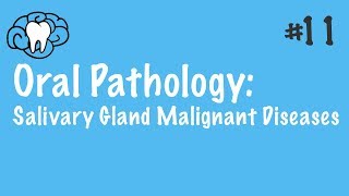 Oral Pathology  Salivary Gland Malignant Diseases  INBDE ADAT [upl. by Nylirehc197]