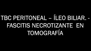 TBC PERITONEAL – ÍLEO BILIAR  FASCITIS NECROTIZANTE EN TOMOGRAFÍA [upl. by Torry]