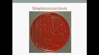 Bacteriology Streptococcus Gram Positive Cocci [upl. by Yadnus]