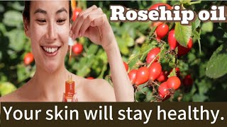 Rosehip Oil The Secret to Healthy Skin and Hair [upl. by Madalyn]