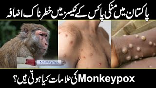 Alert  Monkey pox Virus Spreading in Pakistan  Symptoms amp Causes amp Treatment [upl. by Kinom]