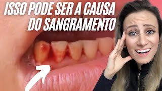 ESSA PODE SER A CAUSA😰 higienebucal fiodental aparelho [upl. by Gorlicki]