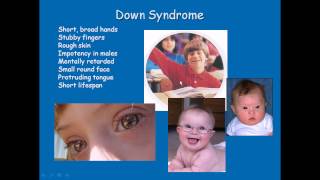 Chromosomal disorders [upl. by Itoyj]