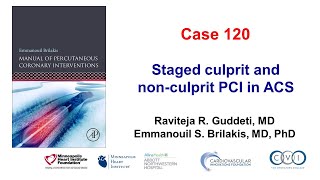 Case 120 PCI Manual Staged culprit and nonculprit PCI [upl. by Noelyn]