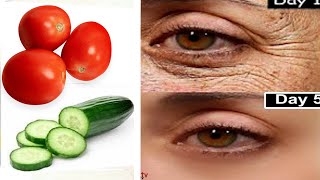 Rub cucumber remedy in 5 mins for 5 days get clear skin Remove wrinkles under eyes naturally forever [upl. by Alfredo]