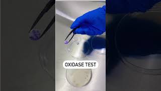 Oxidase Reaction Test  Disc Oxidase Test  Positive Oxidase Reaction microbiology youtubeshorts [upl. by Anuaf905]