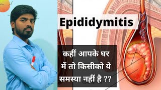 Epididymitis हिंदी में  Explained by K Amitesh singh [upl. by Nrublim188]