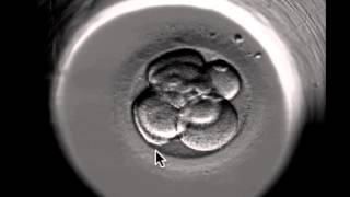 ivf embryo developing over 5 days by fertility Dr Raewyn Teirney [upl. by Eudoxia948]