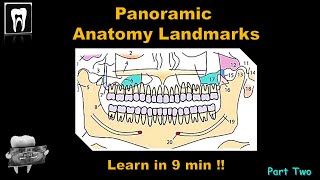 Panoramic Radiography landmarkOrthopantomogramOPGAnatomical LandmarkDental ExamDental Radiology [upl. by Hodgkinson]