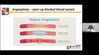 MIOT Hospital amp The Hindu Present Genicular Artery Embolization [upl. by Atiuqal]