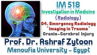 04 Undergraduate Medical Imaging and Radiology Fundamentals  CranioCerebral Injury [upl. by Burris]