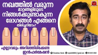 നഖത്തിൽ വരുന്ന മാറ്റങ്ങൾ നോക്കി രോഗങ്ങളെ എങ്ങനെ സ്വയം തിരിച്ചറിയാം  അറിഞ്ഞിരിക്കേണ്ട ഇൻഫർമേഷൻ [upl. by Eetsim]