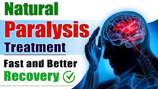 Natural Paralysis Treatment  Fast and Better Recovery  Brain Stroke Recovery  Dr Puru Dhawan [upl. by Nipsirc]