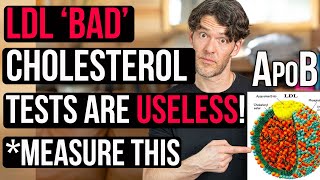 LDLCholesterol is USELESS Measure this Instead ApoB [upl. by Nyer]