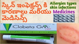 Allergy and Skin Infections with Clobeta Gm Ointment in allopathic in Telugu Tamara in Telugurings [upl. by Iuqcaj]