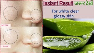 aloe vera gel for skin whitening  aloe vera face pack  aloe vera facial at home [upl. by Nuajed]