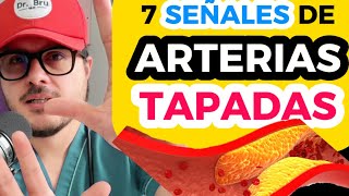 ¡ATENCIÓN ESTOS SÍNTOMAS INDICAN que TIENES ARTERIAS TAPADAS VENAS TAPADAS [upl. by Nreval]