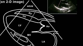 Echocardiography for beginners  the best [upl. by Eiznekcam]