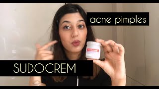 SUDOCREM FOR PIMPLES  SUDOCREM SKINCARE \\ USES\\ SUDOCREM [upl. by Sherm]