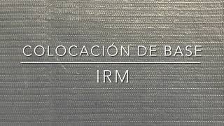 Colocación de IRM base Dra Aby FL [upl. by Brunella]