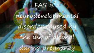 Foetal Fetal Alcohol Syndrome [upl. by Girard]