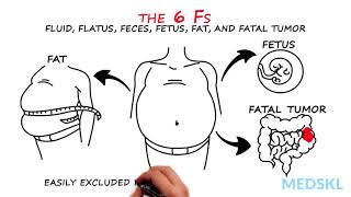 Abdominal Distension The 6 Fs that can help your diagnosis [upl. by Torry]