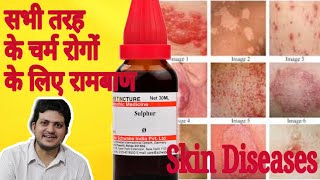 Sulphur Mother Tincture ko kaun kaun si skin disease चर्म रोग में use Karen aur kaise use Karen [upl. by Downing]