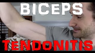 How Biceps Tendonitis Happens [upl. by Tormoria946]