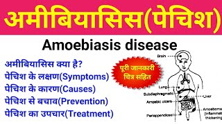 अमीबिएसिस क्या है  amoebiasis treatment symptoms causes  amoebiasis disease in hindi  पेचिश [upl. by Stanly986]