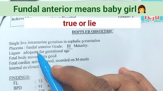 Fundal anterior means baby girlbaby gender with placentaAmmateju [upl. by Sej]