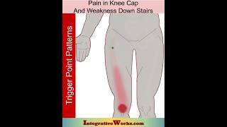 Pain in knee cap and weakness on stairs [upl. by Ainitsirk910]