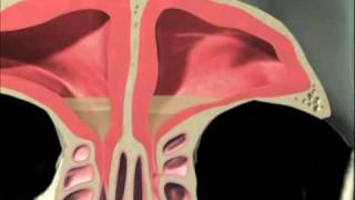 3D Sinus Animation [upl. by Catt782]