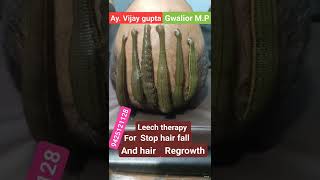 Leech therapy for hair problems [upl. by Harvard]