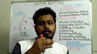 Western Blotting  Principle and Procedure  western blotting technique step by step [upl. by Sarad232]