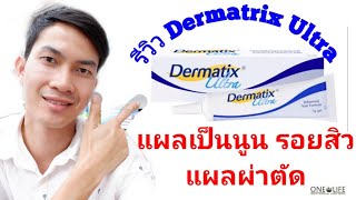 🌱🌿รีวิวการใช้ Dermatrix Ultra กับแผลเป็นนูน รอยสิว แผลผ่าตัด 🌿เภ💊สายเฮลท์🌾 [upl. by Ardith526]