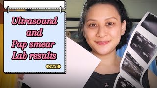 Breast Ultrasound and Pap smear result pia besmonte [upl. by Kcerb]