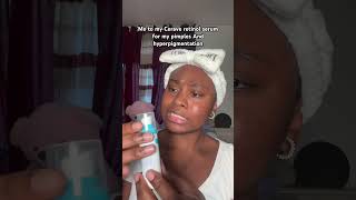 I give this Cerave retinol serum for pimples and hyperpigmentation 30 minutes to work asap😂 [upl. by Aysab]