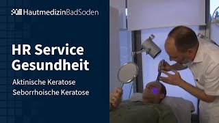 HR Service Gesundheit PDT aktinischer Keratosen Lasertherapie seborrhoischer Keratosen [upl. by Aehtla536]