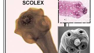 Phylum Platyhelminthes [upl. by Esidnac]