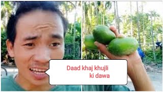 Daad khaj khujli ka ilaj daad khaj khujli ki dawa Ringworm treatment Bimallimbu Daadkhajkhujli [upl. by Assiluy850]