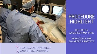 Florida Endovascular amp Interventional  Procedure Highlight 5 Varicocele Embolization [upl. by Acirema]