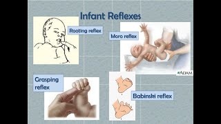 Differences between Grasp Reflex and Moro Reflex Startle reflex seen in Babies [upl. by Henig]